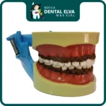 Tipodon con Sarro y Encía Flexible